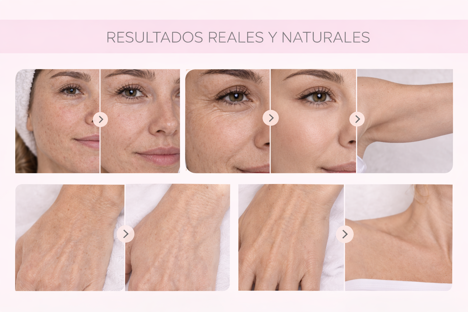 Antes y después de tratamientos estéticos